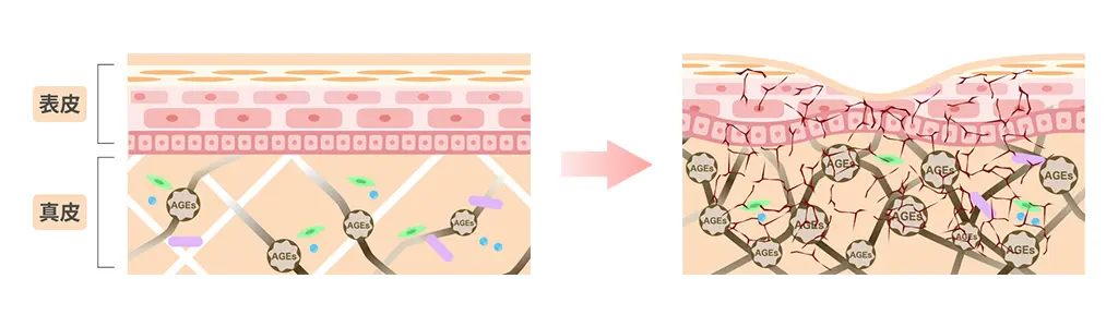 【糖化動画】より肌が滅亡していく様を表現したイラスト