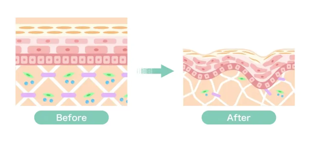 【肌の老化のメカニズムLP】より（左）Before ⇒ （右）after