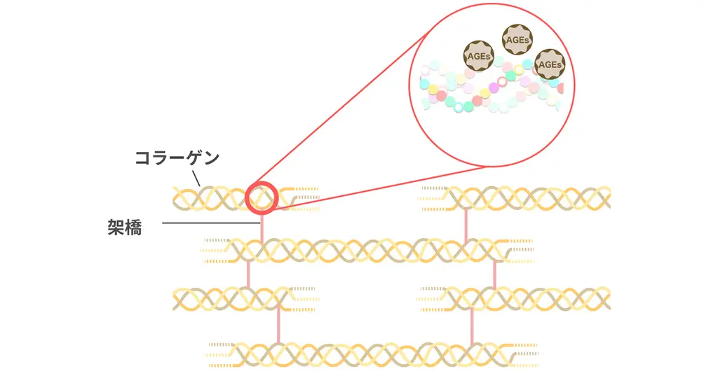 【糖化動画】より異常な架橋の形成を表現したイラスト(1)