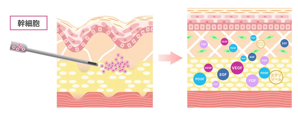 【糖化動画】より成長因子が線維芽細胞を活性化するイメージイラスト