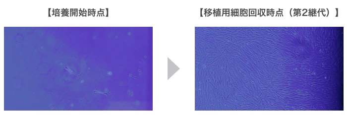 左「培養開始時点」⇒右「移植用細胞回収時点（第2継代）」の写真