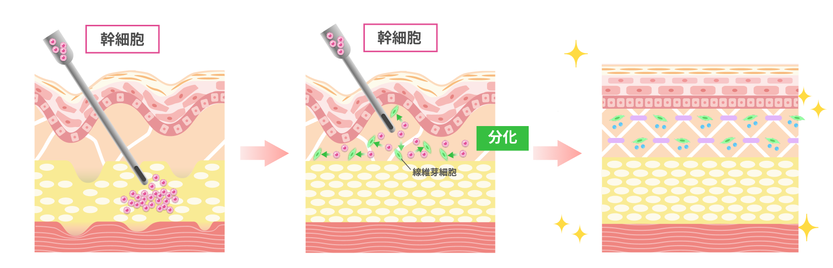 期待されるメカニズムの図