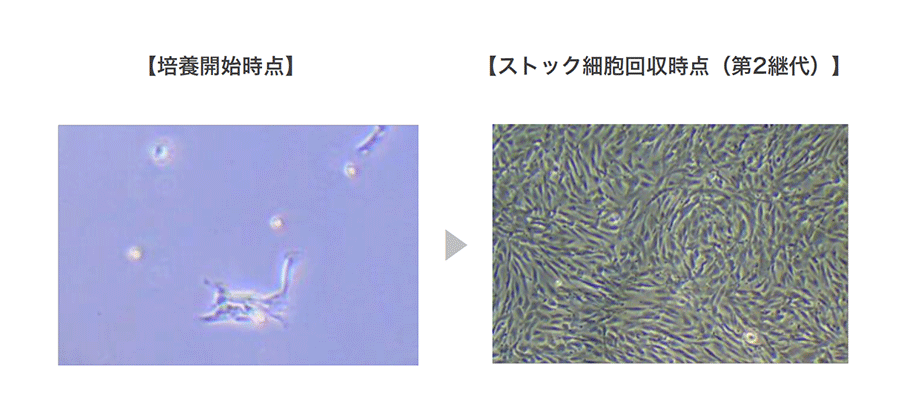 【培養開始時点】と【ストック細胞回収時点（第2代）】の比較