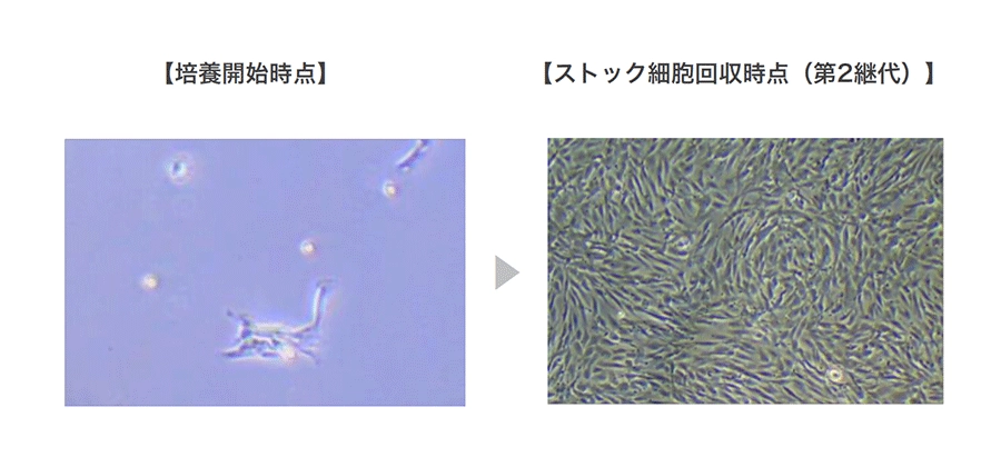 【培養開始時点】と【ストック細胞回収時点（第2代）】の比較