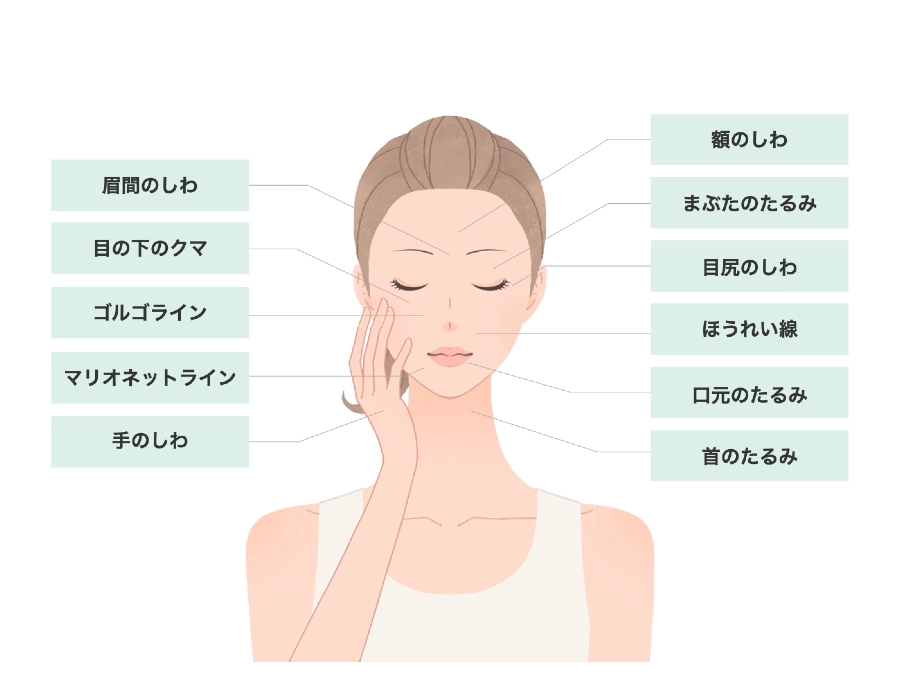 真皮線維芽細胞再生治療による期待される効果　眉間のしわ,目の下のクマ,ゴルゴライン,マリオネットライン,手のしわ,額のしわ,まぶたのたるみ,目尻のしわ,ほうれい線,口元のたるみ,首のたるみ