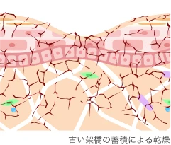After（古い架橋の蓄積による乾燥した肌を表現したイラスト）