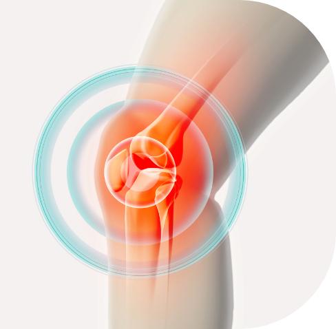 変形性膝関節症の特徴