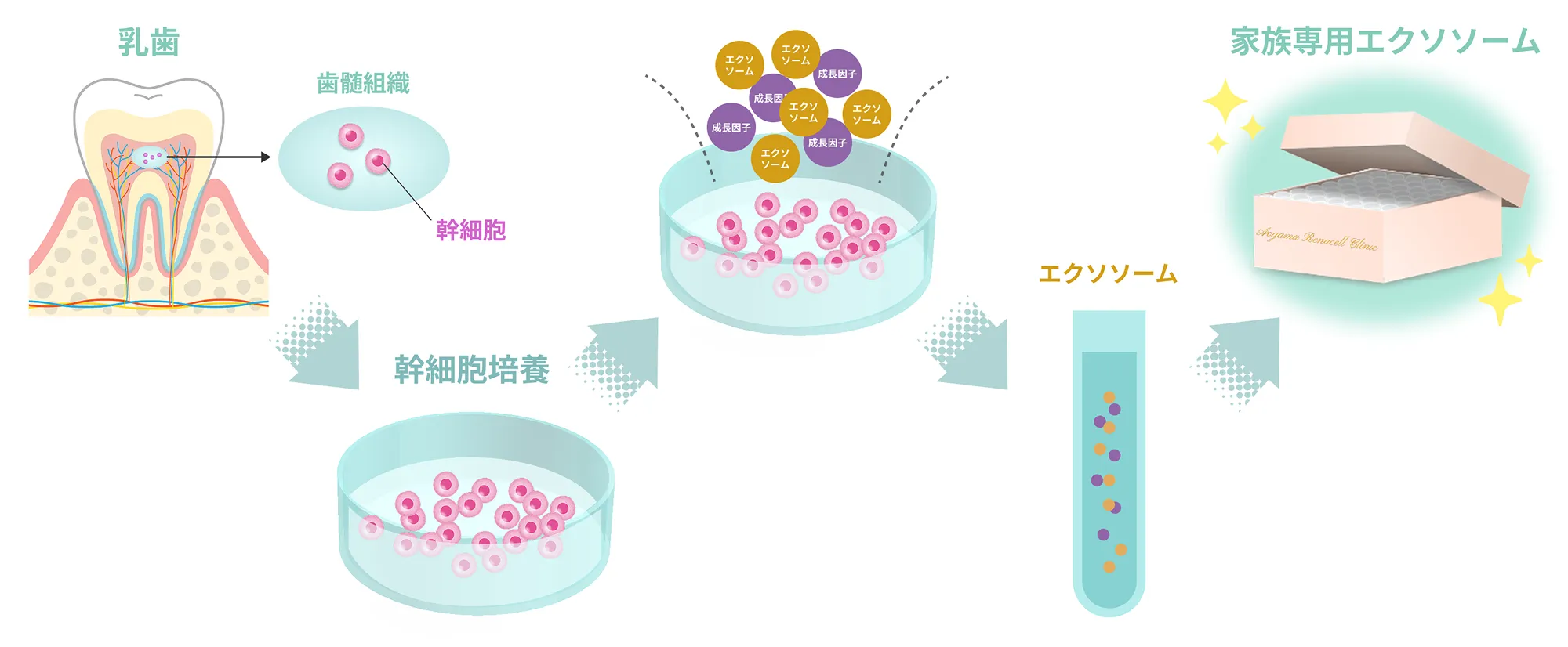 乳歯から活性度の高い幹細胞を抽出してオーダーメイドの培養上清液(エクソソーム)を製造